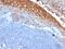 Melanoma Cell Adhesion Molecule antibody, GTX34461, GeneTex, Immunohistochemistry paraffin image 