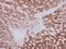 Glycyl-TRNA Synthetase antibody, GTX114421, GeneTex, Immunohistochemistry paraffin image 