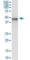 MAGE Family Member C2 antibody, H00051438-B01P, Novus Biologicals, Western Blot image 