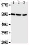 Cytochrome P450 Family 19 Subfamily A Member 1 antibody, PA5-79125, Invitrogen Antibodies, Western Blot image 