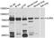 Interleukin 5 Receptor Subunit Alpha antibody, A8552, ABclonal Technology, Western Blot image 