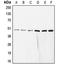 COP9 Signalosome Subunit 3 antibody, LS-C353067, Lifespan Biosciences, Western Blot image 