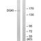 Diacylglycerol Kinase Iota antibody, PA5-49774, Invitrogen Antibodies, Western Blot image 