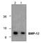 Growth Differentiation Factor 7 antibody, GTX59685, GeneTex, Western Blot image 