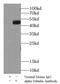 Tubulin Alpha 1b antibody, FNab00335, FineTest, Immunoprecipitation image 