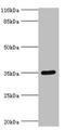Sulfotransferase Family 1B Member 1 antibody, CSB-PA022937EA01HU, Cusabio, Western Blot image 