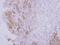 Oxysterol Binding Protein Like 5 antibody, LS-C155522, Lifespan Biosciences, Immunohistochemistry paraffin image 