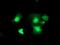 Thymidylate kinase antibody, MA5-25678, Invitrogen Antibodies, Immunocytochemistry image 