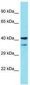 MAPK Activated Protein Kinase 2 antibody, TA342907, Origene, Western Blot image 