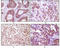 Inhibitor Of Nuclear Factor Kappa B Kinase Subunit Beta antibody, M00118-2, Boster Biological Technology, Immunohistochemistry paraffin image 