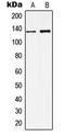 Potassium Calcium-Activated Channel Subfamily M Alpha 1 antibody, LS-C352423, Lifespan Biosciences, Western Blot image 