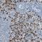 Mcl antibody, NBP1-84445, Novus Biologicals, Immunohistochemistry paraffin image 