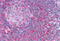 TPD52 Like 2 antibody, MBS247061, MyBioSource, Immunohistochemistry paraffin image 