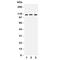 Transient Receptor Potential Cation Channel Subfamily C Member 4 antibody, R31431, NSJ Bioreagents, Western Blot image 