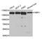 NBR1 Autophagy Cargo Receptor antibody, MBS129599, MyBioSource, Western Blot image 