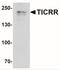 TOPBP1 Interacting Checkpoint And Replication Regulator antibody, NBP2-41283, Novus Biologicals, Western Blot image 