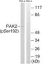 P21 (RAC1) Activated Kinase 2 antibody, PA5-39749, Invitrogen Antibodies, Western Blot image 
