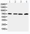 Interleukin 1 Receptor Associated Kinase 2 antibody, PA2236, Boster Biological Technology, Western Blot image 