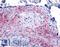 Neuroepithelial Cell Transforming 1 antibody, LS-A3409, Lifespan Biosciences, Immunohistochemistry paraffin image 