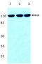 BUB1 Mitotic Checkpoint Serine/Threonine Kinase B antibody, A01564T368, Boster Biological Technology, Western Blot image 