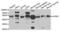 Killer Cell Lectin Like Receptor K1 antibody, abx004687, Abbexa, Western Blot image 