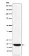 P53 Apoptosis Effector Related To PMP22 antibody, M03926, Boster Biological Technology, Western Blot image 