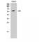 Mitogen-Activated Protein Kinase Kinase Kinase 8 antibody, LS-C382866, Lifespan Biosciences, Western Blot image 