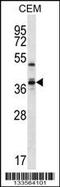 WD Repeat Domain 25 antibody, 57-013, ProSci, Western Blot image 