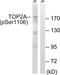 DNA Topoisomerase II Alpha antibody, LS-C199674, Lifespan Biosciences, Western Blot image 