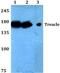 Treacle Ribosome Biogenesis Factor 1 antibody, PA5-75250, Invitrogen Antibodies, Western Blot image 