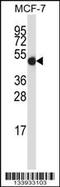 GDP Dissociation Inhibitor 2 antibody, 57-273, ProSci, Western Blot image 