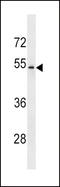 Fc Fragment Of IgG Receptor And Transporter antibody, LS-C159637, Lifespan Biosciences, Western Blot image 