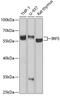 Interferon Regulatory Factor 5 antibody, GTX54336, GeneTex, Western Blot image 