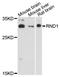 Rho Family GTPase 1 antibody, LS-C748742, Lifespan Biosciences, Western Blot image 