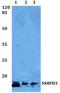 Small Nuclear Ribonucleoprotein D3 Polypeptide antibody, A09533, Boster Biological Technology, Western Blot image 