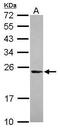 RAB35, Member RAS Oncogene Family antibody, PA5-31674, Invitrogen Antibodies, Western Blot image 