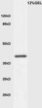 Kruppel Like Factor 2 antibody, GTX03383, GeneTex, Western Blot image 