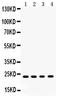 Retinol Binding Protein 4 antibody, PB9360, Boster Biological Technology, Western Blot image 