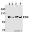 Kinase Suppressor Of Ras 1 antibody, A03285, Boster Biological Technology, Western Blot image 