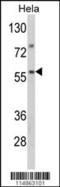 Seryl-TRNA Synthetase 2, Mitochondrial antibody, 63-228, ProSci, Western Blot image 