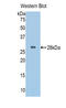 Alpha-1-B Glycoprotein antibody, LS-C292730, Lifespan Biosciences, Western Blot image 