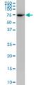 PLS1 antibody, H00005357-M04, Novus Biologicals, Western Blot image 