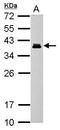 Cone-rod homeobox protein antibody, GTX124188, GeneTex, Western Blot image 