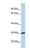 Zinc Finger CCHC-Type Containing 24 antibody, NBP1-56437, Novus Biologicals, Western Blot image 