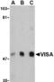 Mitochondrial Antiviral Signaling Protein antibody, MBS150569, MyBioSource, Western Blot image 