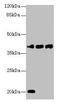 STEAP Family Member 1 antibody, CSB-PA13354A0Rb, Cusabio, Western Blot image 