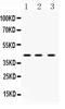 Heterogeneous Nuclear Ribonucleoprotein F antibody, A05806, Boster Biological Technology, Western Blot image 