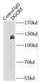 DGCR8 Microprocessor Complex Subunit antibody, FNab02353, FineTest, Immunoprecipitation image 