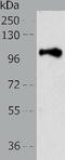 Proteasome 26S Subunit, Non-ATPase 2 antibody, TA322956, Origene, Western Blot image 