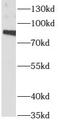 Aryl Hydrocarbon Receptor Nuclear Translocator antibody, FNab00594, FineTest, Western Blot image 